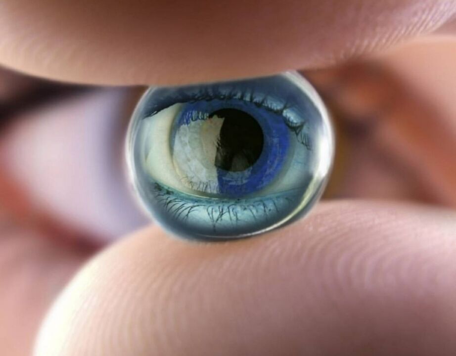 Nakts ortokeratoloģiskie objektīvi apturēs redzes traucējumu progresu